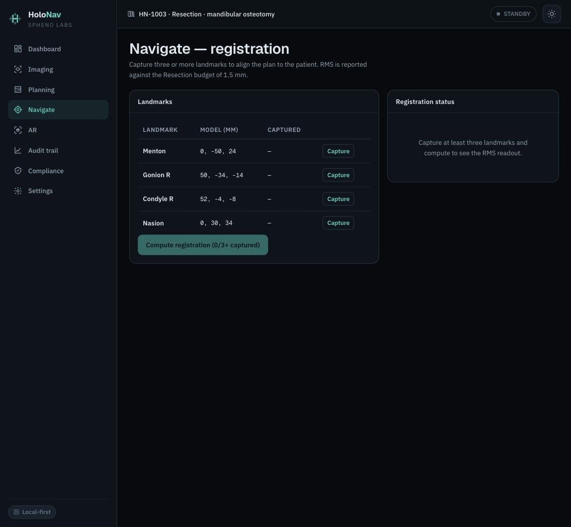 HoloNav navigate: landmark registration with RMS readout